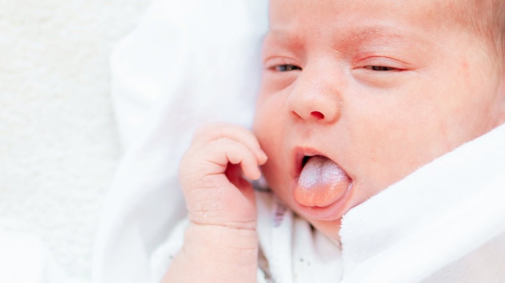 The Importance of Tongue Posture in Newborns - innobaby